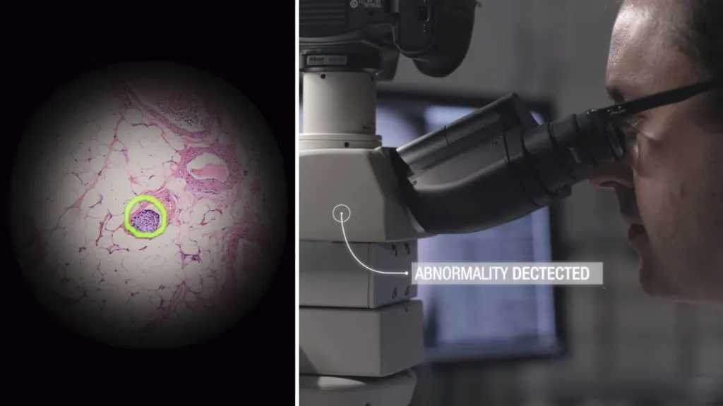 Google's Augmented Reality Microscope Quickly Highlights Cancer Cells